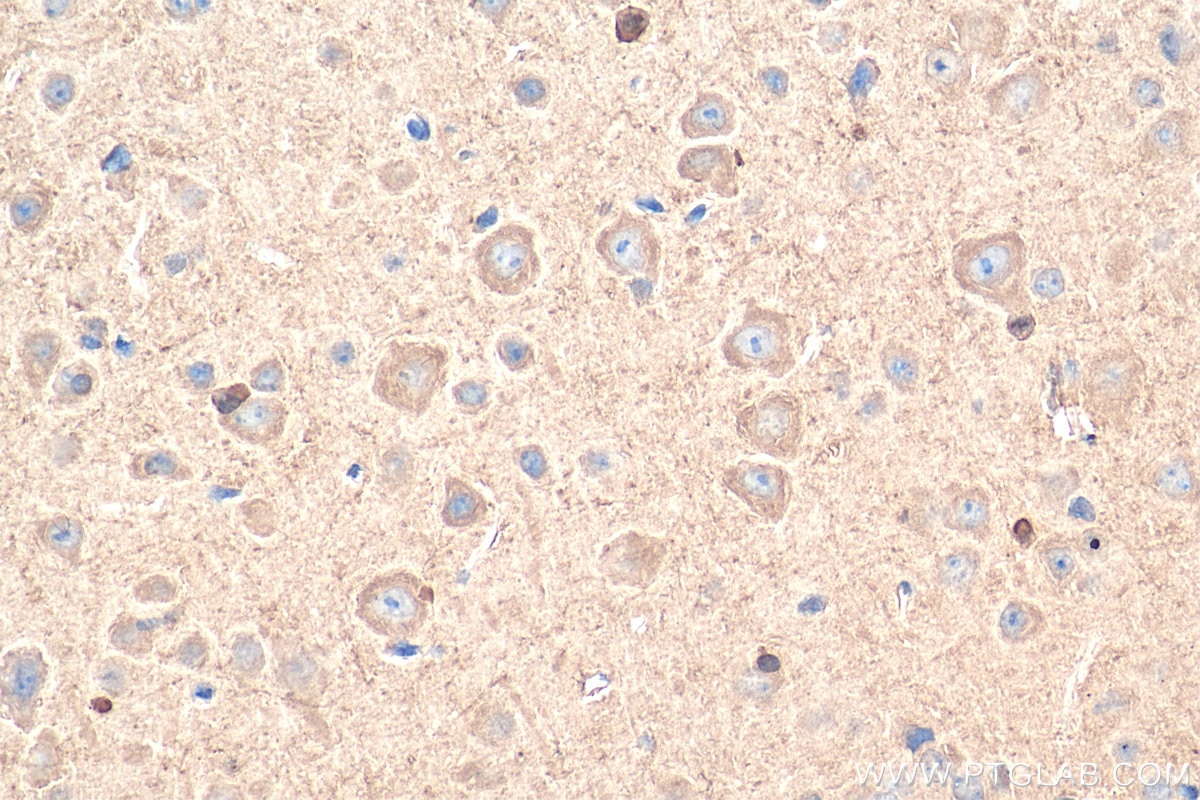 Immunohistochemistry (IHC) staining of mouse brain tissue using USH1G Polyclonal antibody (21936-1-AP)