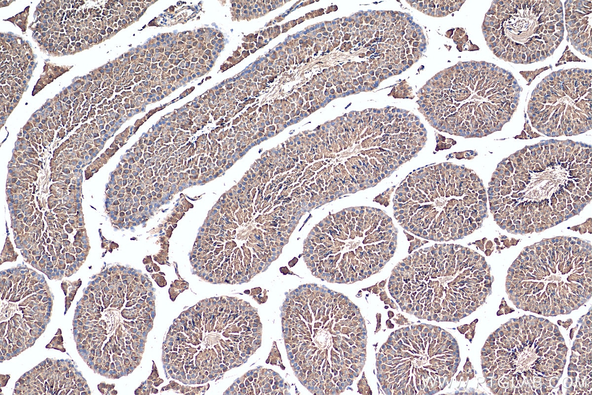 IHC staining of mouse testis using 21936-1-AP