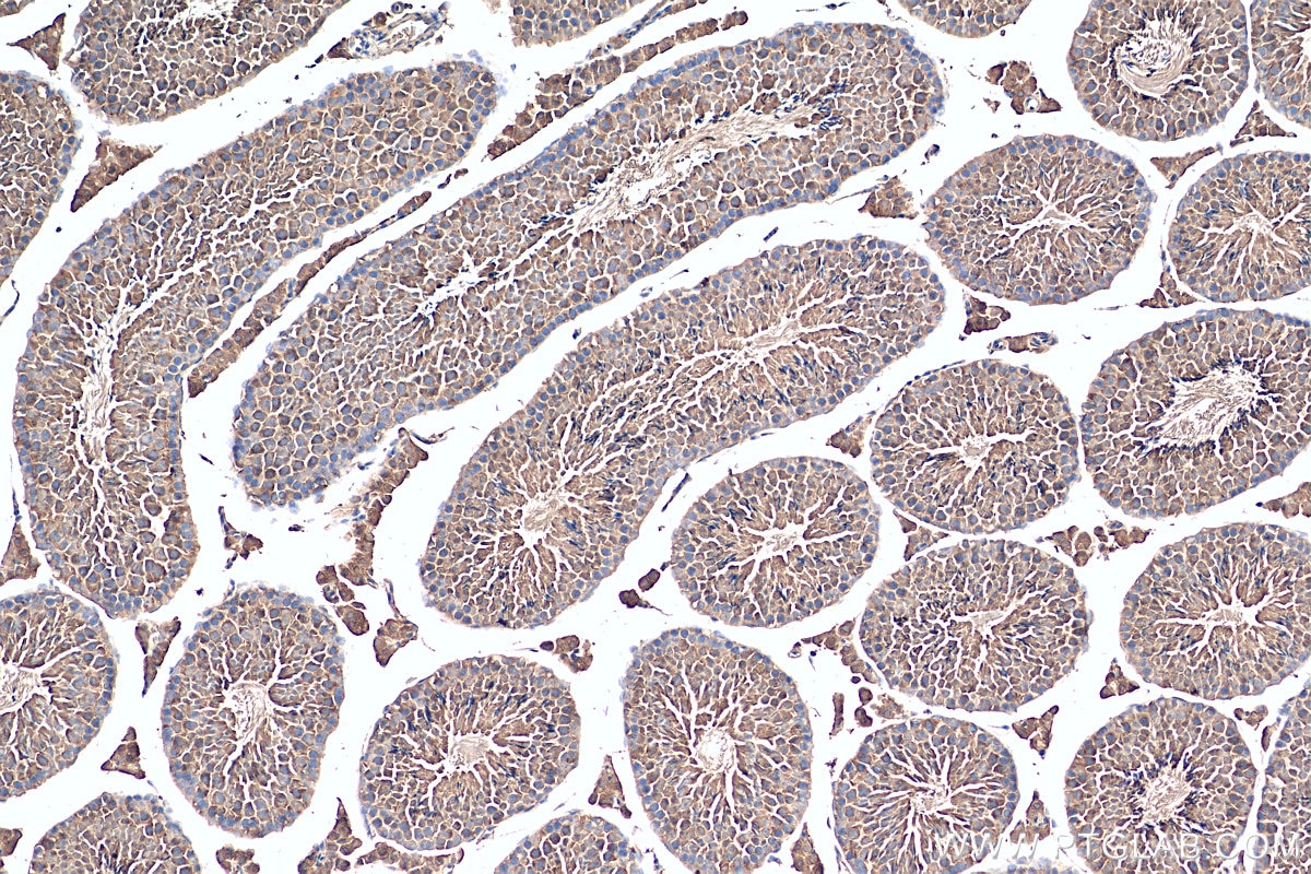 Immunohistochemistry (IHC) staining of mouse testis tissue using USH1G Polyclonal antibody (21936-1-AP)