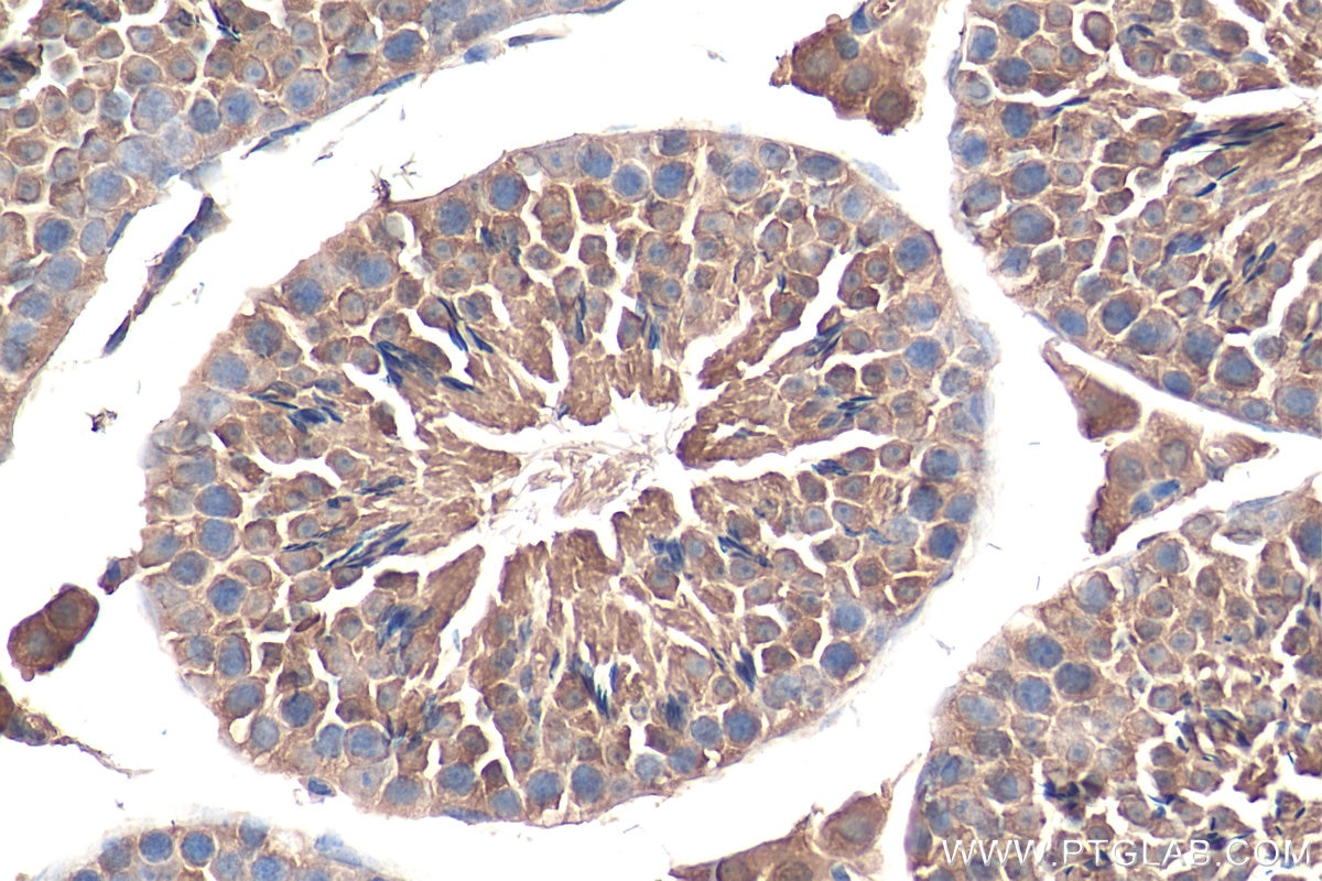 Immunohistochemistry (IHC) staining of mouse testis tissue using USH1G Polyclonal antibody (21936-1-AP)