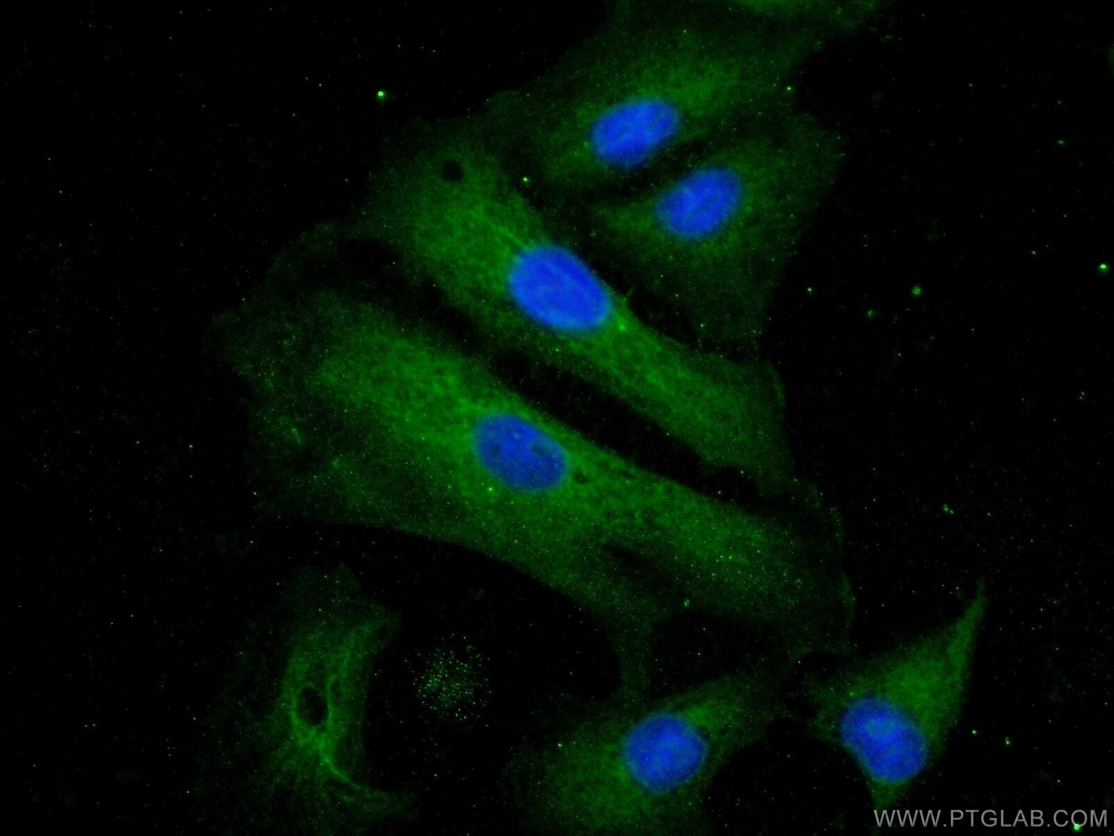 Immunofluorescence (IF) / fluorescent staining of A549 cells using USHBP1 Polyclonal antibody (17226-1-AP)