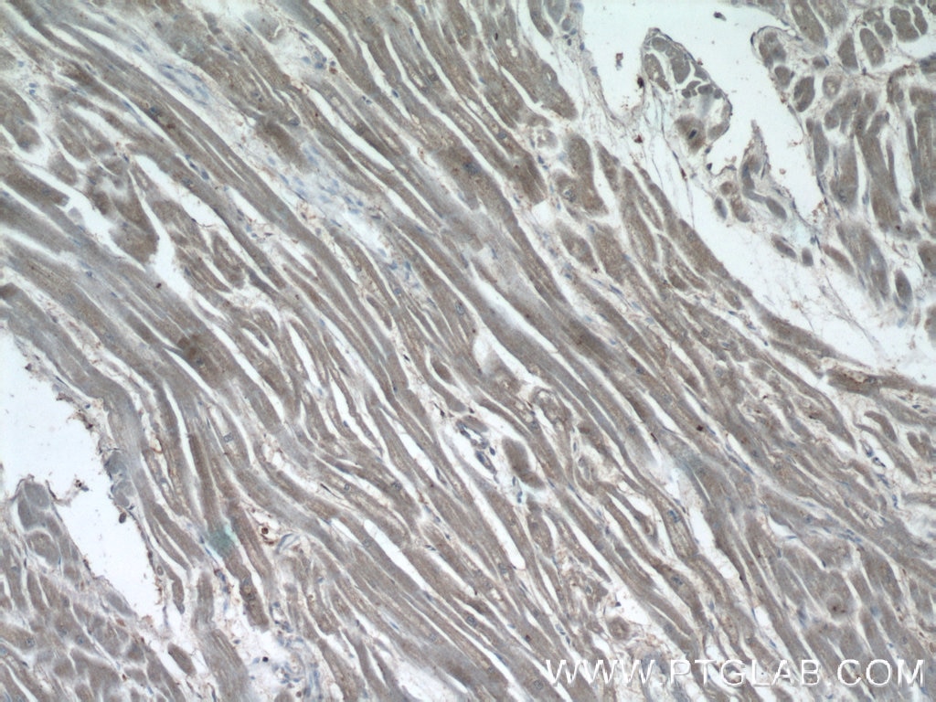 Immunohistochemistry (IHC) staining of human heart tissue using USHBP1 Polyclonal antibody (17226-1-AP)