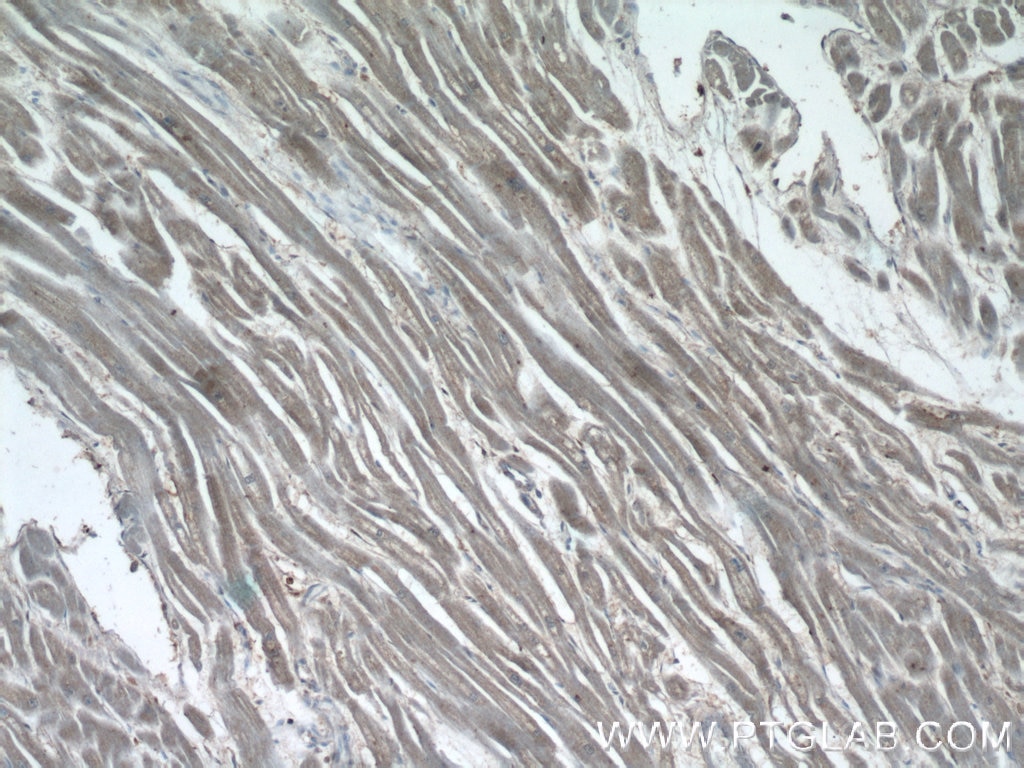 IHC staining of human heart using 17226-1-AP