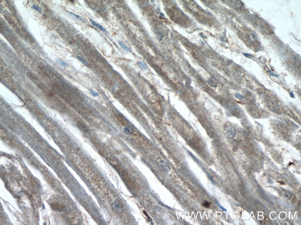 IHC staining of human heart using 17226-1-AP