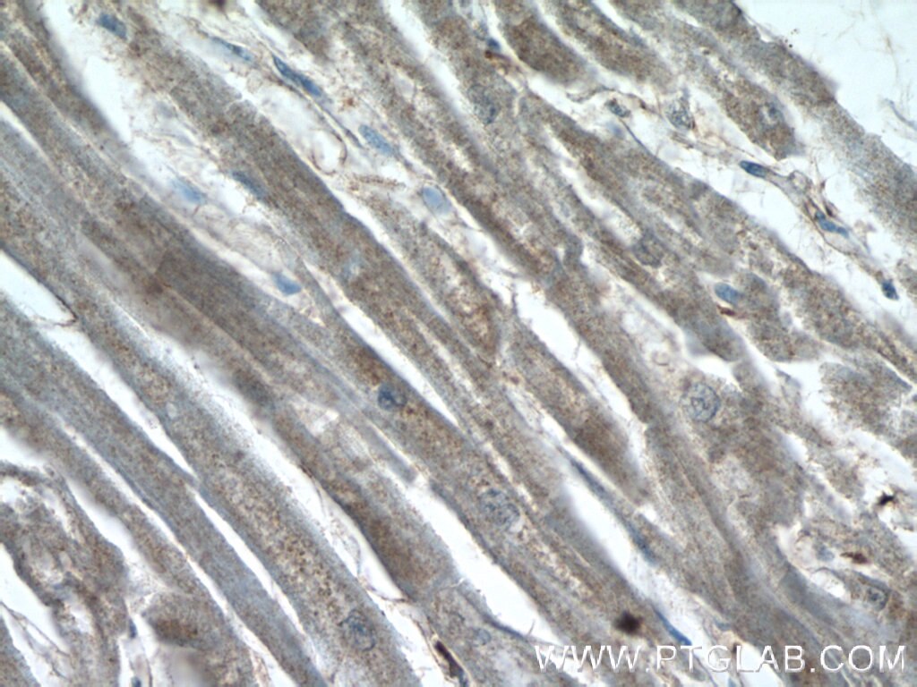 Immunohistochemistry (IHC) staining of human heart tissue using USHBP1 Polyclonal antibody (17226-1-AP)