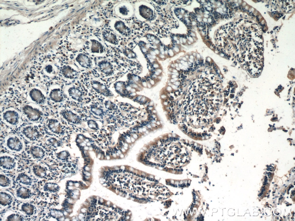 Immunohistochemistry (IHC) staining of human small intestine tissue using USHBP1 Polyclonal antibody (17226-1-AP)