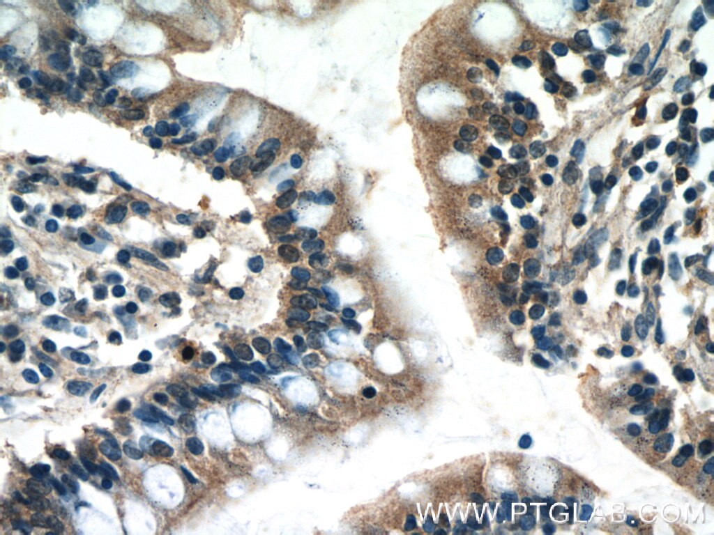 Immunohistochemistry (IHC) staining of human small intestine tissue using USHBP1 Polyclonal antibody (17226-1-AP)