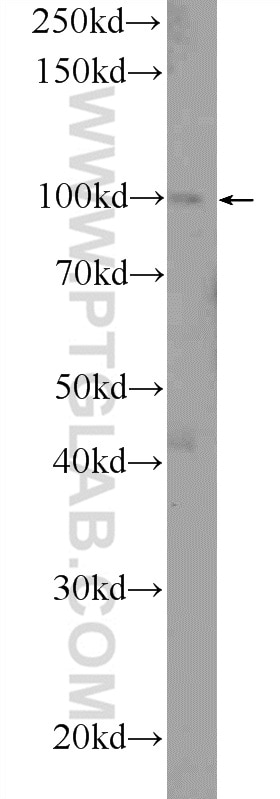 WB analysis of COLO 320 using 17226-1-AP