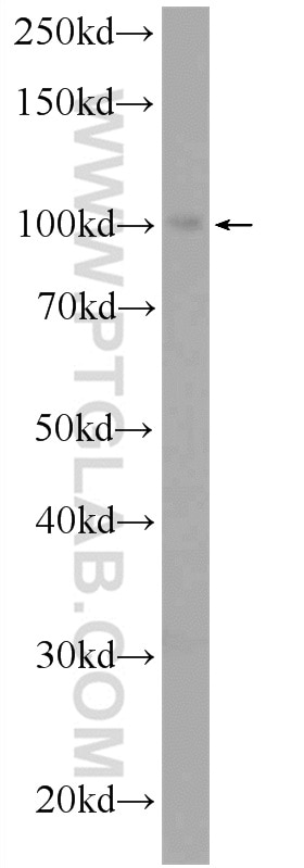 Western Blot (WB) analysis of mouse heart tissue using USHBP1 Polyclonal antibody (17226-1-AP)