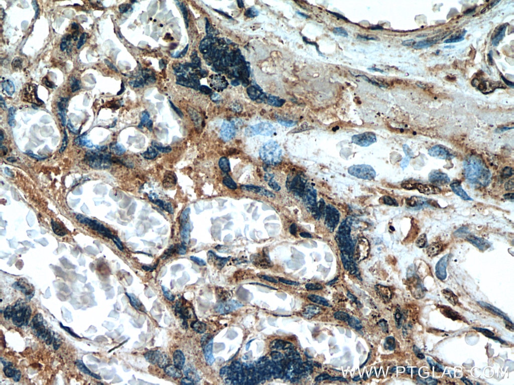 Immunohistochemistry (IHC) staining of human placenta tissue using USMG5 Polyclonal antibody (17716-1-AP)