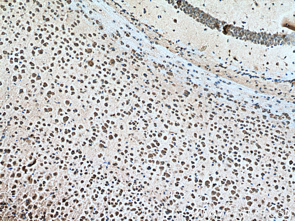 Immunohistochemistry (IHC) staining of mouse brain tissue using USMG5 Polyclonal antibody (17716-1-AP)