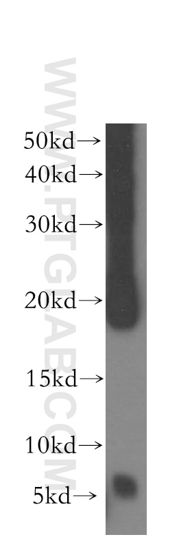 Western Blot (WB) analysis of human brain tissue using USMG5 Polyclonal antibody (17716-1-AP)