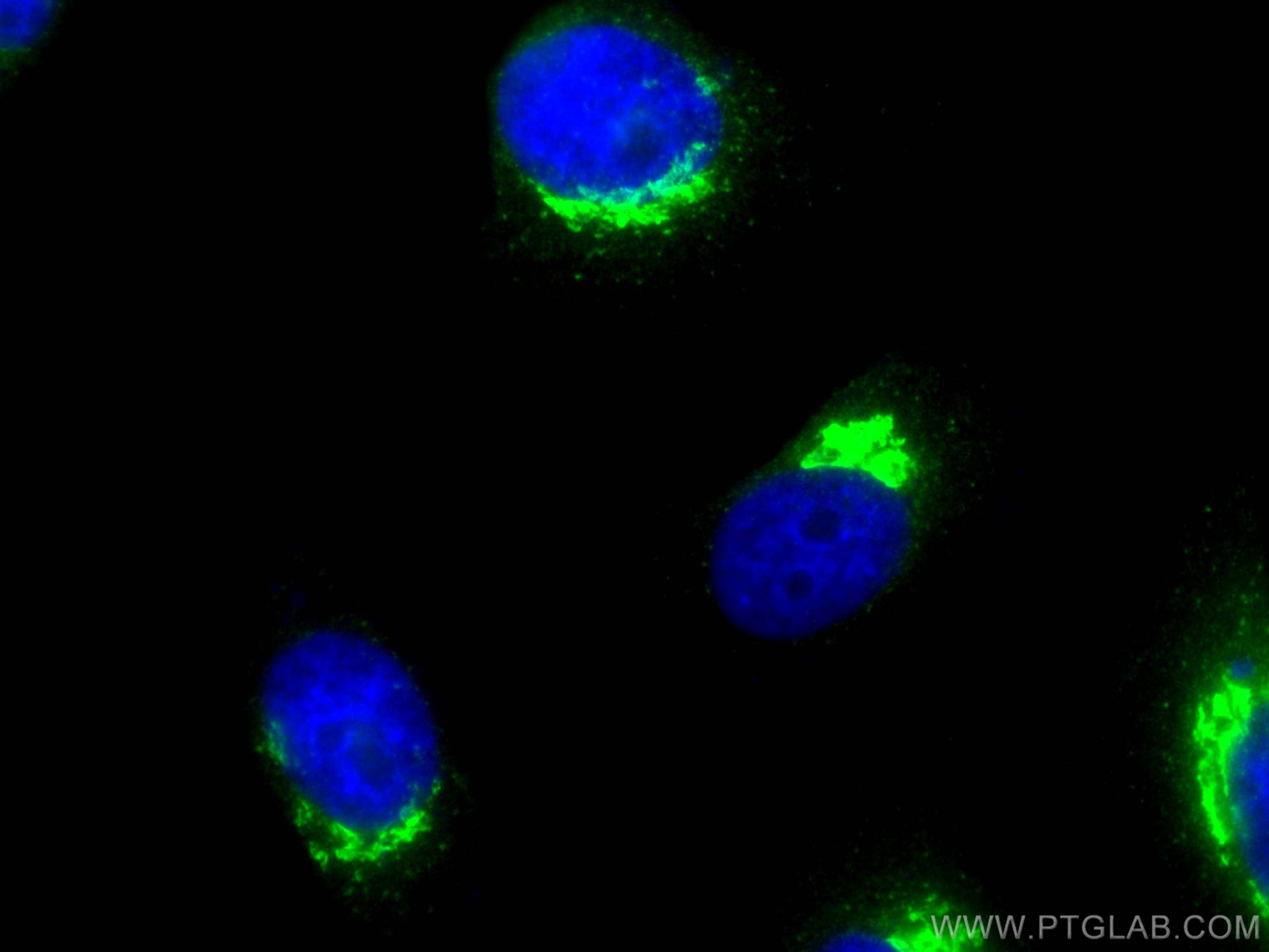 Immunofluorescence (IF) / fluorescent staining of HeLa cells using p115, USO1 Polyclonal antibody (13509-1-AP)