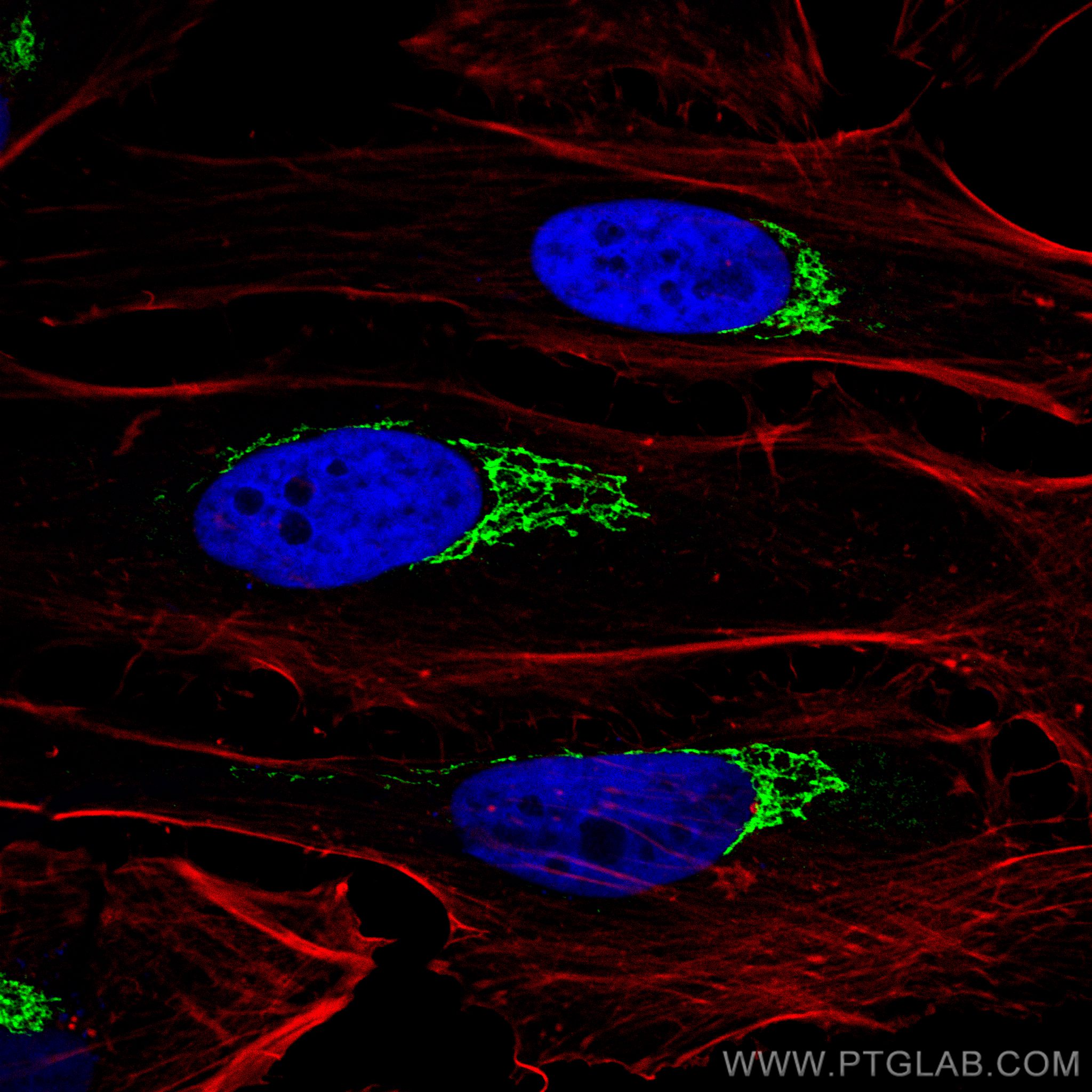 IF Staining of HeLa using 13509-1-AP