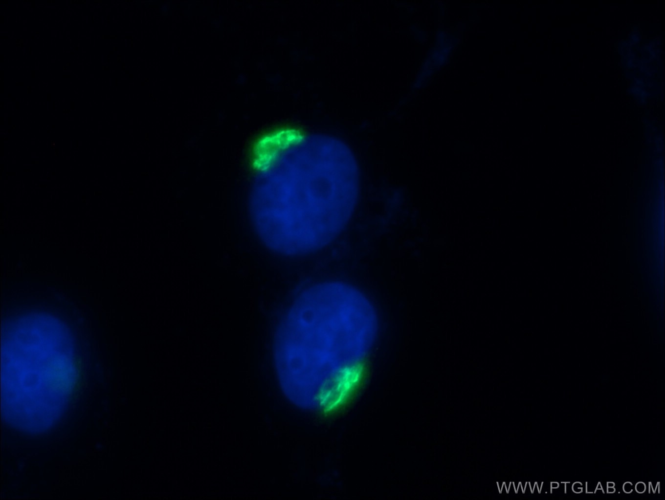 Immunofluorescence (IF) / fluorescent staining of HeLa cells using p115, USO1 Polyclonal antibody (13509-1-AP)