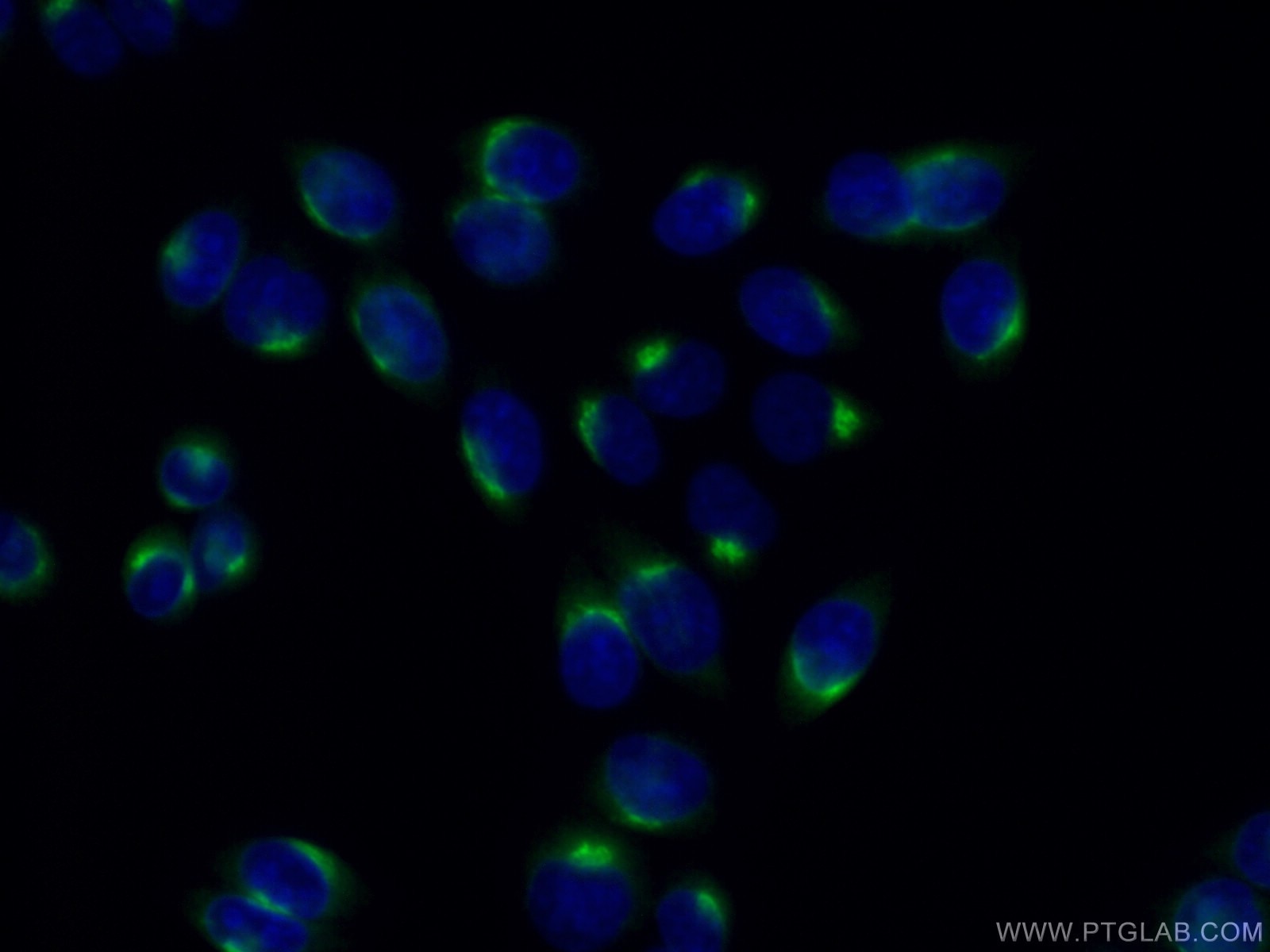 IF Staining of HeLa using 13509-1-AP