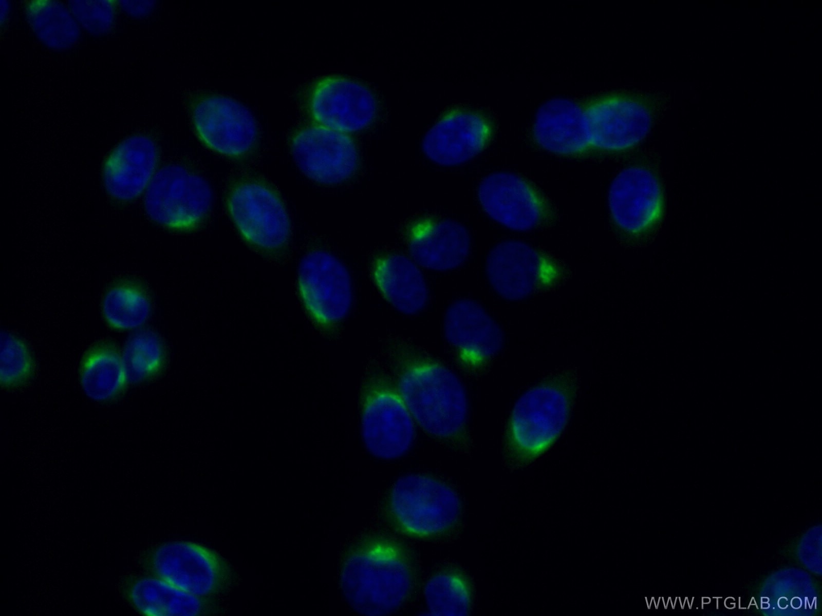 Immunofluorescence (IF) / fluorescent staining of HeLa cells using p115, USO1 Polyclonal antibody (13509-1-AP)