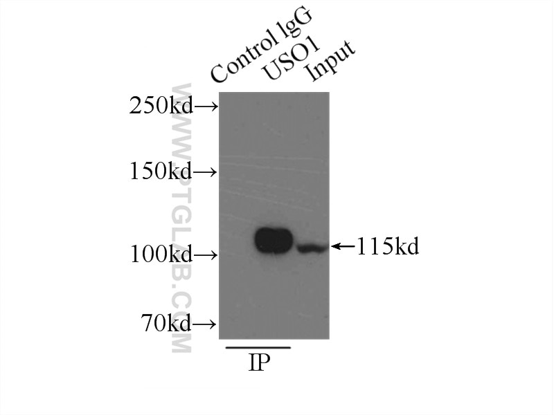 Immunoprecipitation (IP) experiment of mouse brain tissue using p115, USO1 Polyclonal antibody (13509-1-AP)