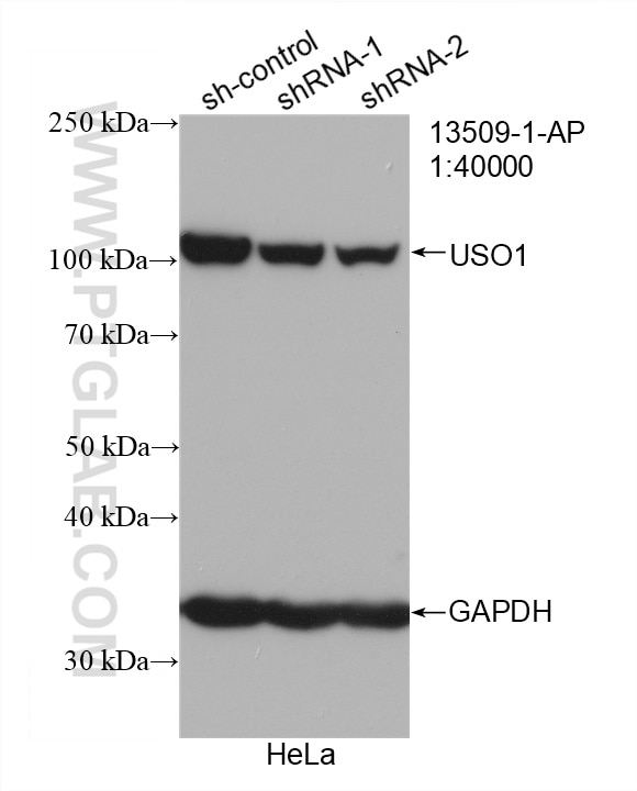 Western Blot (WB) analysis of HeLa cells using p115, USO1 Polyclonal antibody (13509-1-AP)
