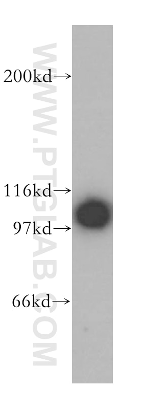 Western Blot (WB) analysis of mouse testis tissue using p115, USO1 Polyclonal antibody (13509-1-AP)