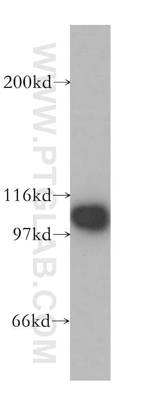 Western Blot (WB) analysis of mouse thymus tissue using p115, USO1 Polyclonal antibody (13509-1-AP)