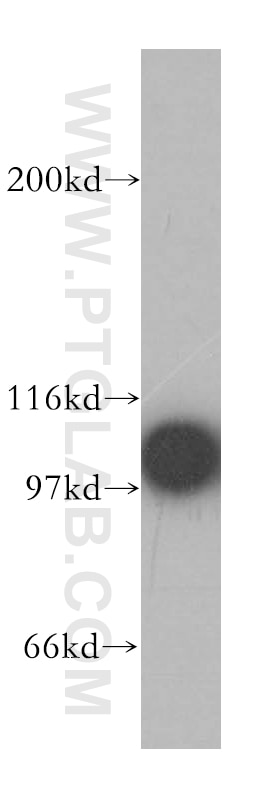 Western Blot (WB) analysis of human brain tissue using p115, USO1 Polyclonal antibody (13509-1-AP)