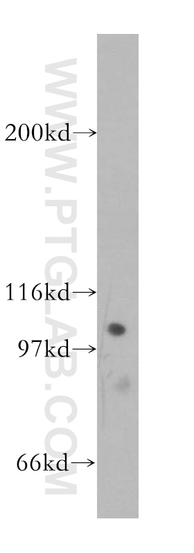 Western Blot (WB) analysis of SH-SY5Y cells using p115, USO1 Polyclonal antibody (13509-1-AP)