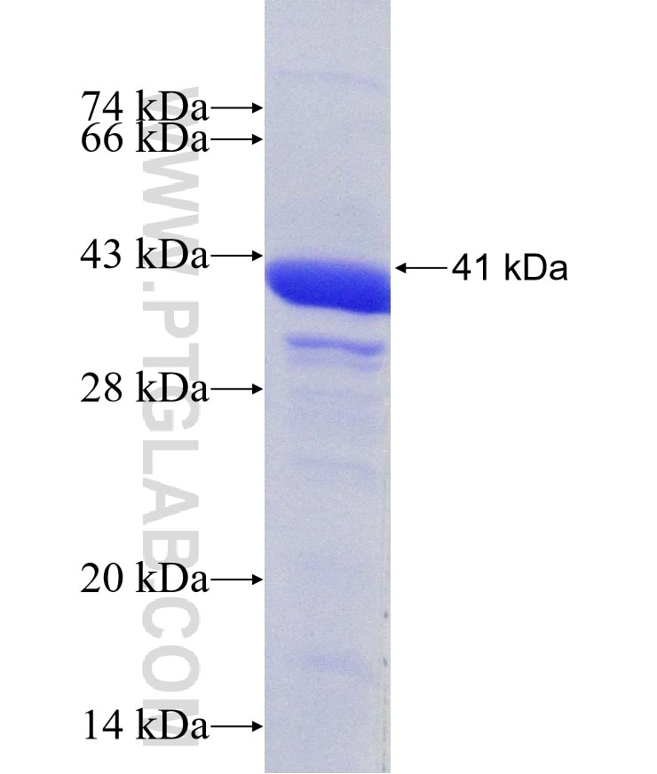 p115, USO1 fusion protein Ag5543 SDS-PAGE