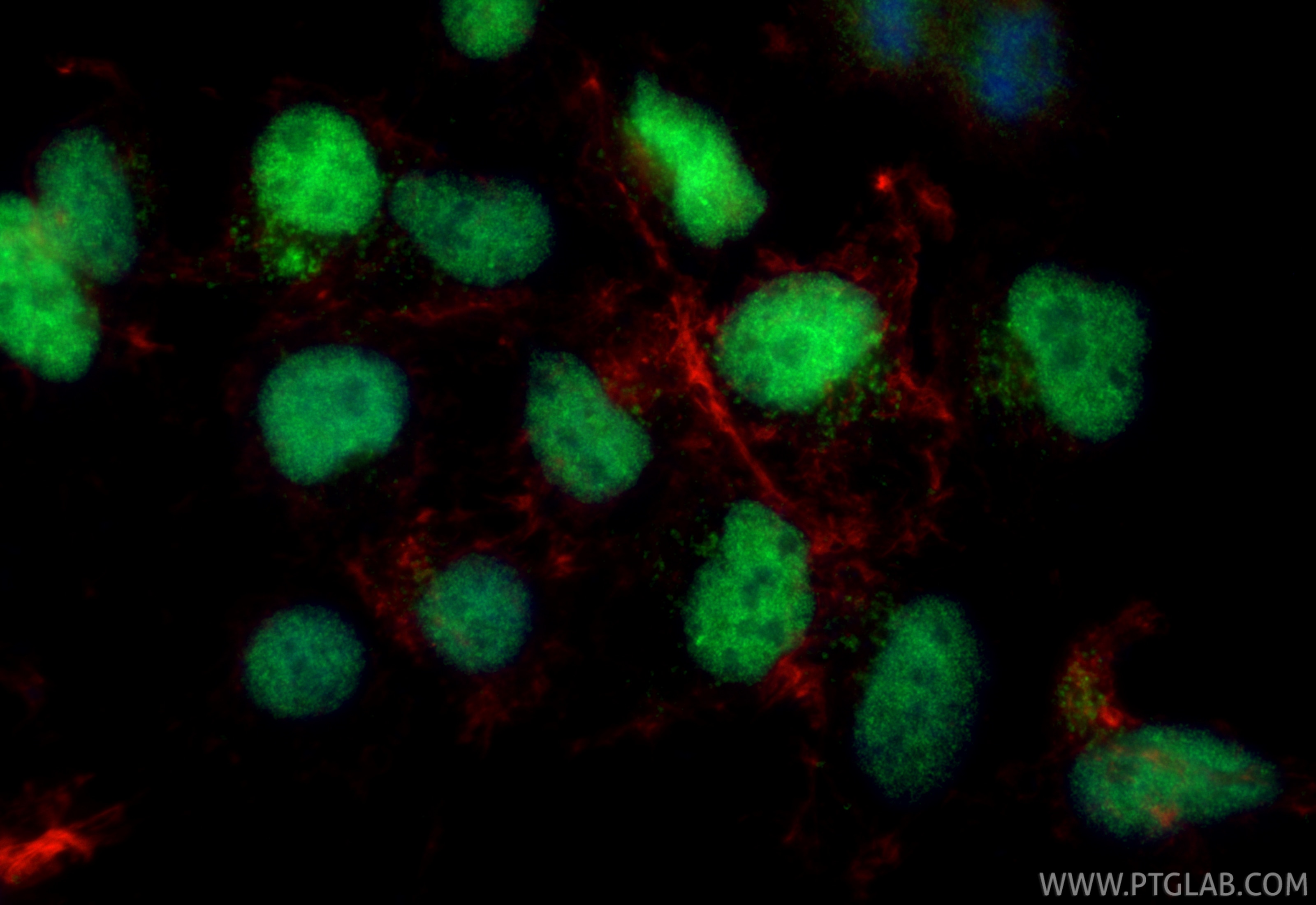 Immunofluorescence (IF) / fluorescent staining of HEK-293 cells using USP1 Polyclonal antibody (14346-1-AP)