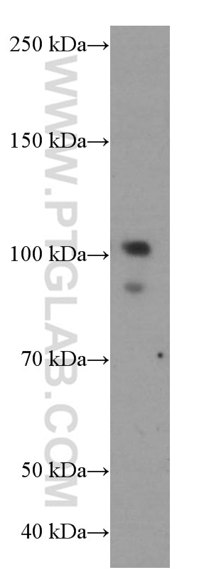 Western Blot (WB) analysis of HeLa cells using USP1 Monoclonal antibody (66069-1-Ig)