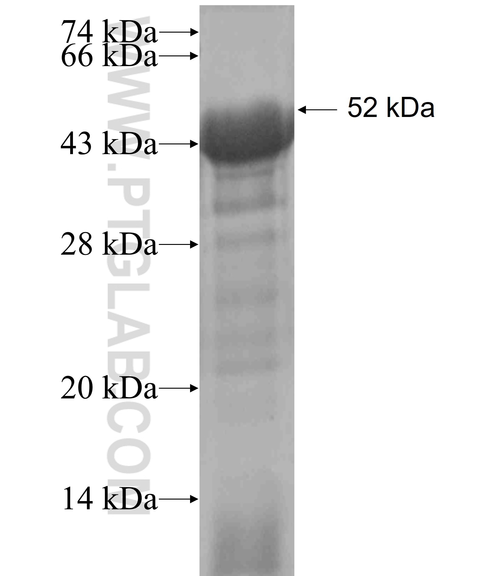 USP1 fusion protein Ag5904 SDS-PAGE