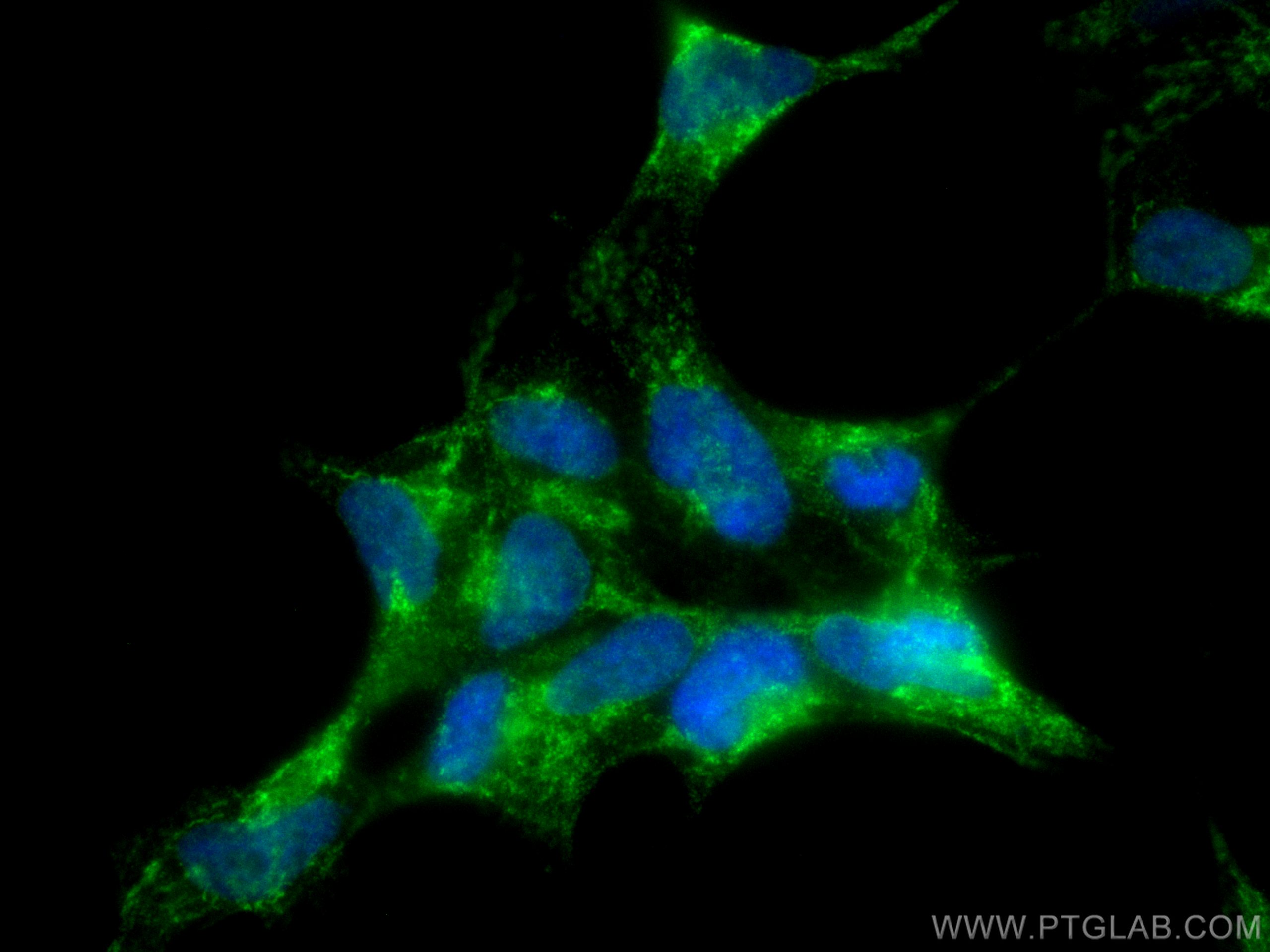 Immunofluorescence (IF) / fluorescent staining of HEK-293 cells using USP10 Polyclonal antibody (19374-1-AP)