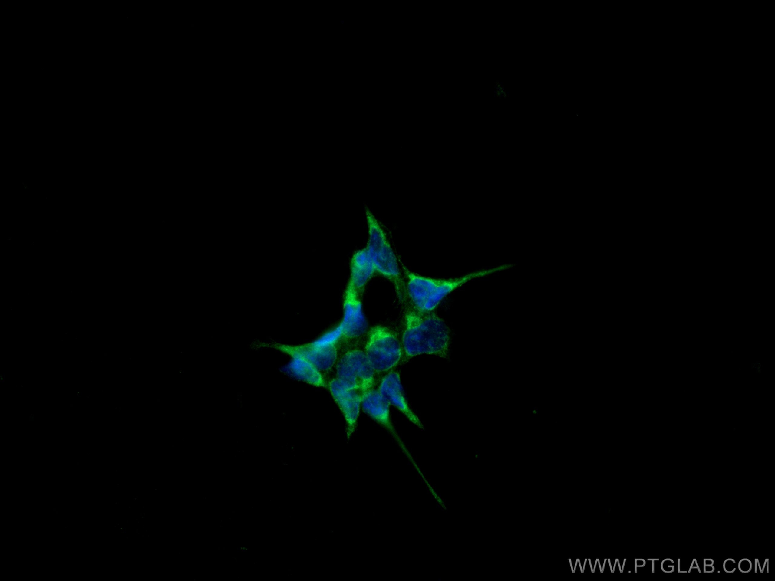 Immunofluorescence (IF) / fluorescent staining of HEK-293 cells using USP10 Polyclonal antibody (19374-1-AP)