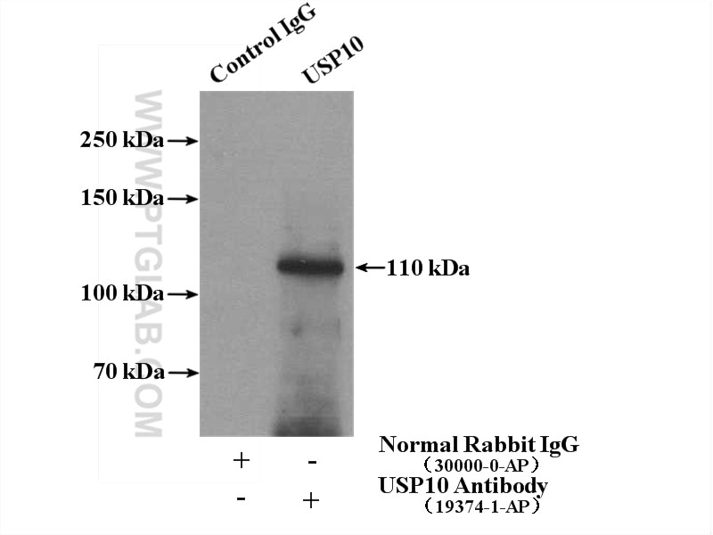 Immunoprecipitation (IP) experiment of HeLa cells using USP10 Polyclonal antibody (19374-1-AP)