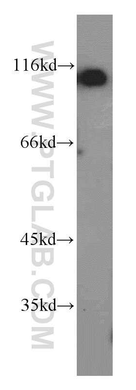 USP10 Polyclonal antibody