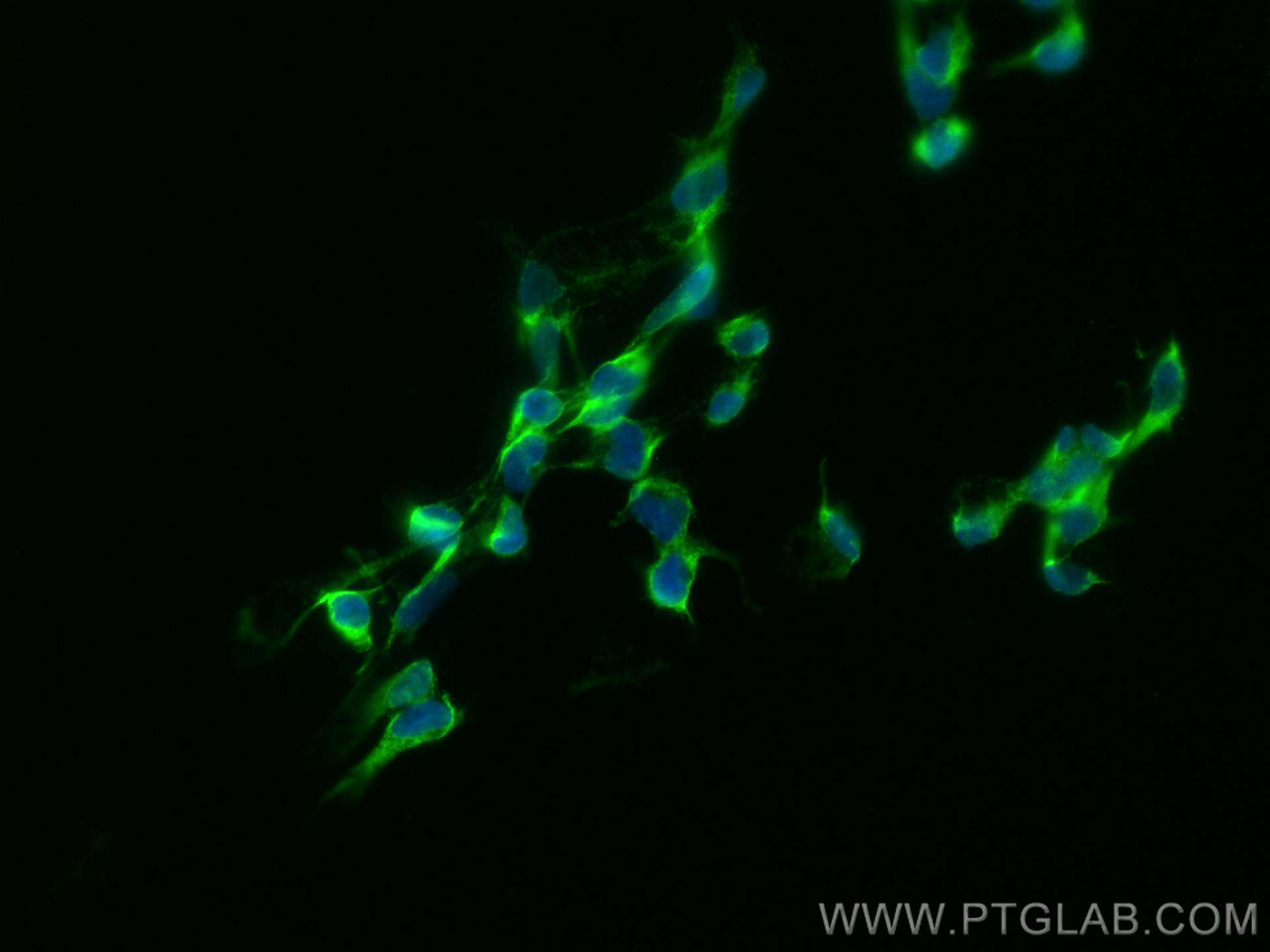 Immunofluorescence (IF) / fluorescent staining of HEK-293 cells using USP10 Monoclonal antibody (67917-1-Ig)