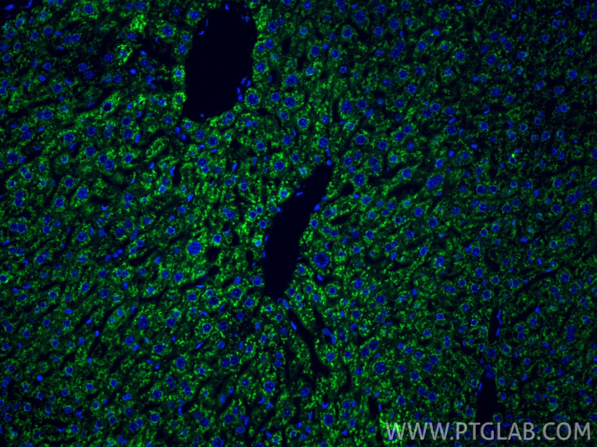 Immunofluorescent analysis of (4% PFA) fixed paraffin-embedded mouse liver tissue using USP10 antibody (67917-1-Ig, Clone: 1B10C9 ) at dilution of 1:400 and CoraLite®488-Conjugated Goat Anti-Mouse IgG(H+L) (SA00013-1). Heat mediated antigen retrieval with Tris-EDTA buffer (pH 9.0). Immunofluorescence (IF) / fluorescent staining of mouse liver tissue using USP10 Monoclonal antibody (67917-1-Ig)