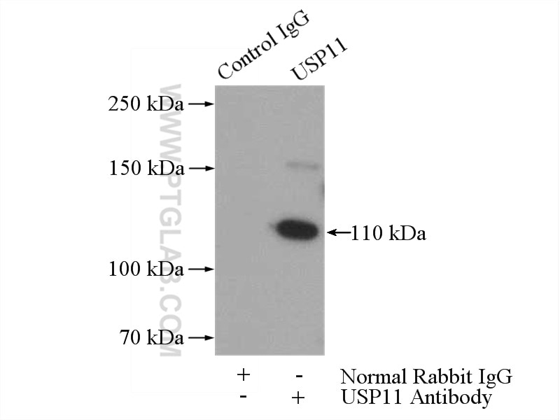 Immunoprecipitation (IP) experiment of HEK-293 cells using USP11 Polyclonal antibody (10244-1-AP)