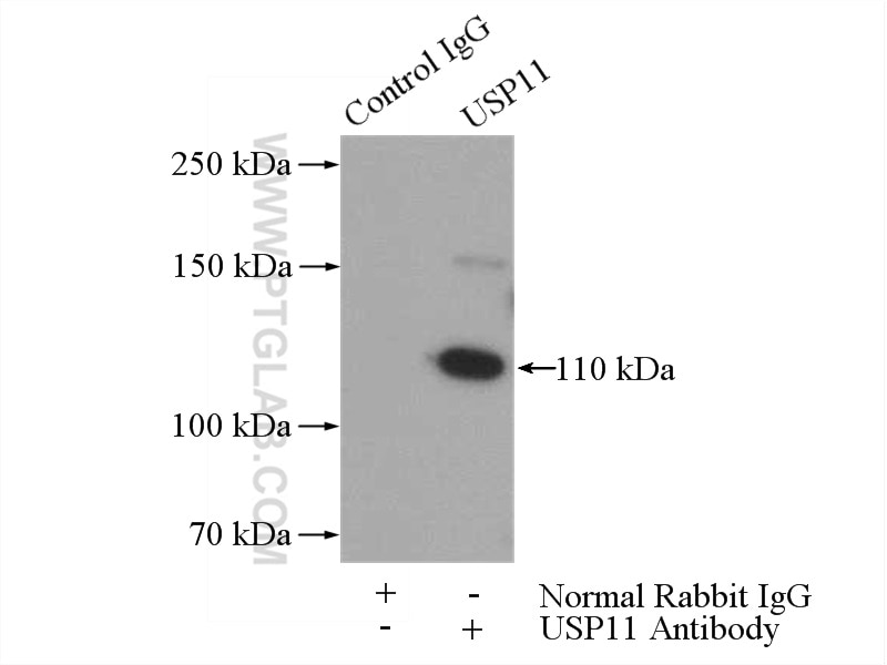 IP experiment of HEK-293 using 10244-1-AP