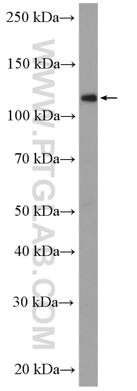 Western Blot (WB) analysis of Jurkat cells using USP11 Polyclonal antibody (10244-1-AP)