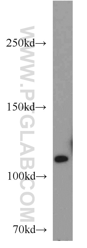 Western Blot (WB) analysis of human testis tissue using USP11 Polyclonal antibody (10244-1-AP)