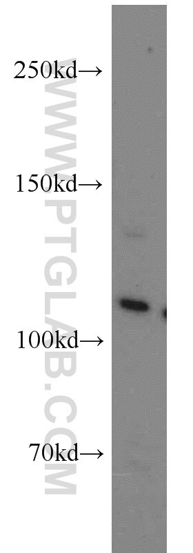 Western Blot (WB) analysis of HEK-293 cells using USP11 Polyclonal antibody (10244-1-AP)
