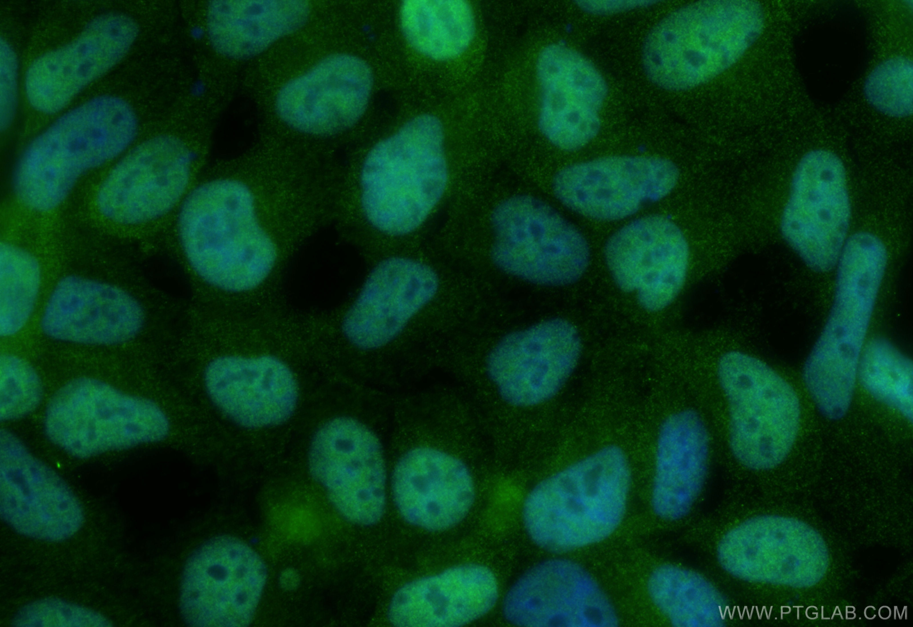 Immunofluorescence (IF) / fluorescent staining of HEK-293 cells using USP11 Polyclonal antibody (22340-1-AP)