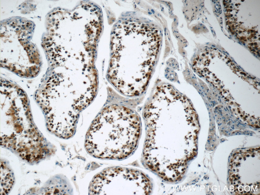 Immunohistochemistry (IHC) staining of human testis tissue using USP11 Polyclonal antibody (22340-1-AP)