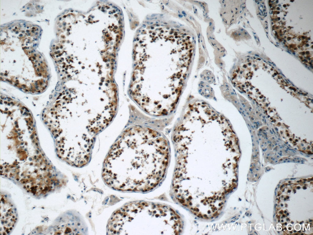 Immunohistochemistry (IHC) staining of human testis tissue using USP11 Polyclonal antibody (22340-1-AP)