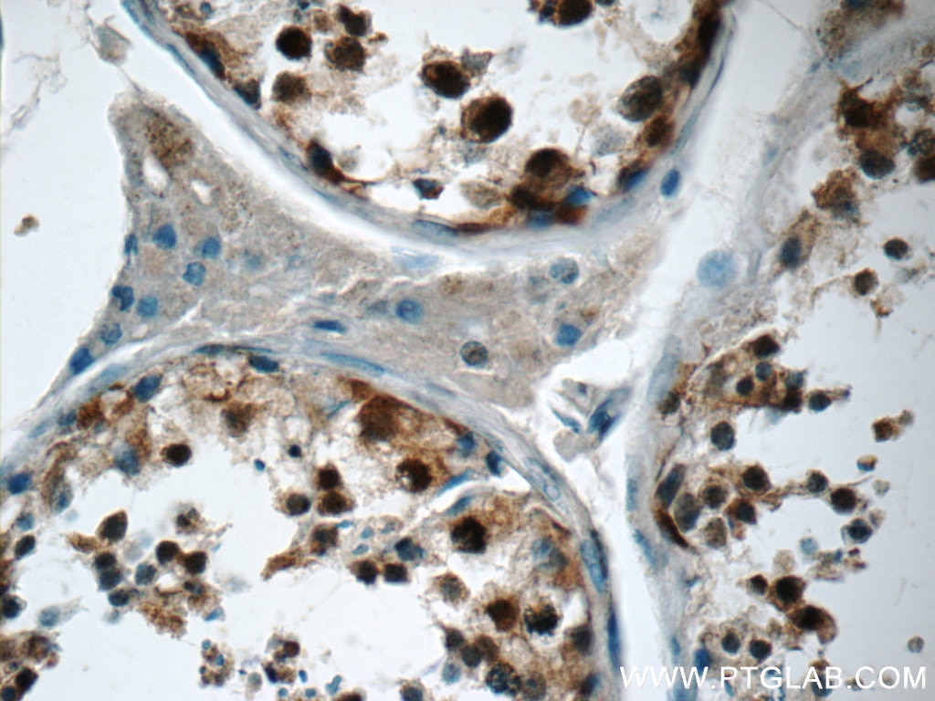 Immunohistochemistry (IHC) staining of human testis tissue using USP11 Polyclonal antibody (22340-1-AP)