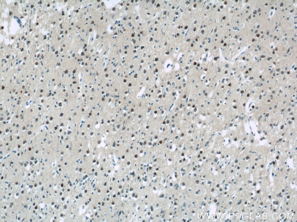 Immunohistochemistry (IHC) staining of human brain tissue using USP11 Polyclonal antibody (22340-1-AP)
