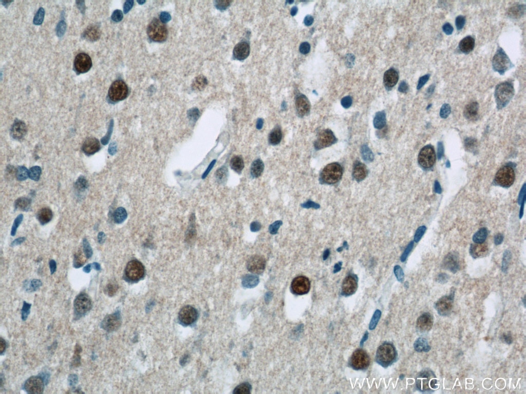 Immunohistochemistry (IHC) staining of human brain tissue using USP11 Polyclonal antibody (22340-1-AP)