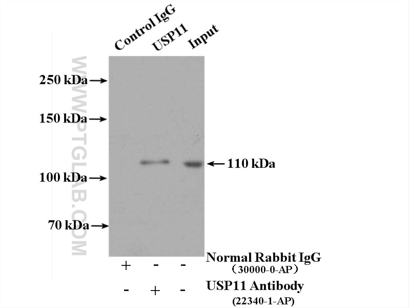 Immunoprecipitation (IP) experiment of HEK-293 cells using USP11 Polyclonal antibody (22340-1-AP)
