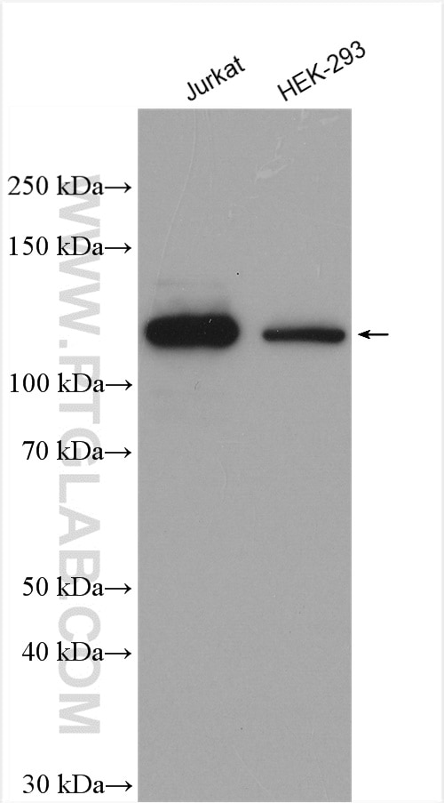 Western Blot (WB) analysis of various lysates using USP11 Polyclonal antibody (22340-1-AP)